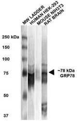 HSPA5 / GRP78 / BiP Antibody (clone 3C5-1A4)