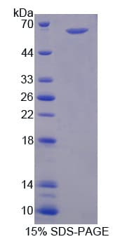 Human PAD2 / PADI2 Protein (Recombinant His-GST)