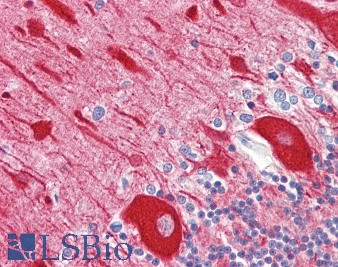 PathPlus™ Polyclonal Rabbit anti-Human TUBB / Beta Tubulin Antibody (aa401-450, IHC, WB)