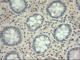 Monoclonal Mouse anti-Human MYC / c-Myc Antibody (clone OTI1A6, IHC, IF, WB)