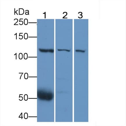 VCL / Vinculin Antibody