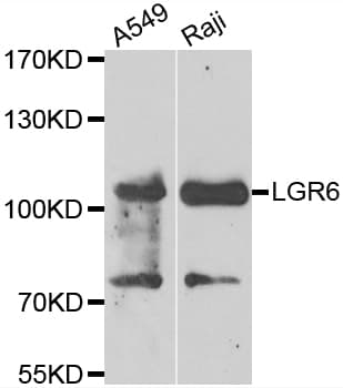 LGR6 Antibody