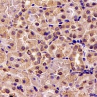 Polyclonal Rabbit anti-Human HS1BP3 Antibody (IHC, WB)
