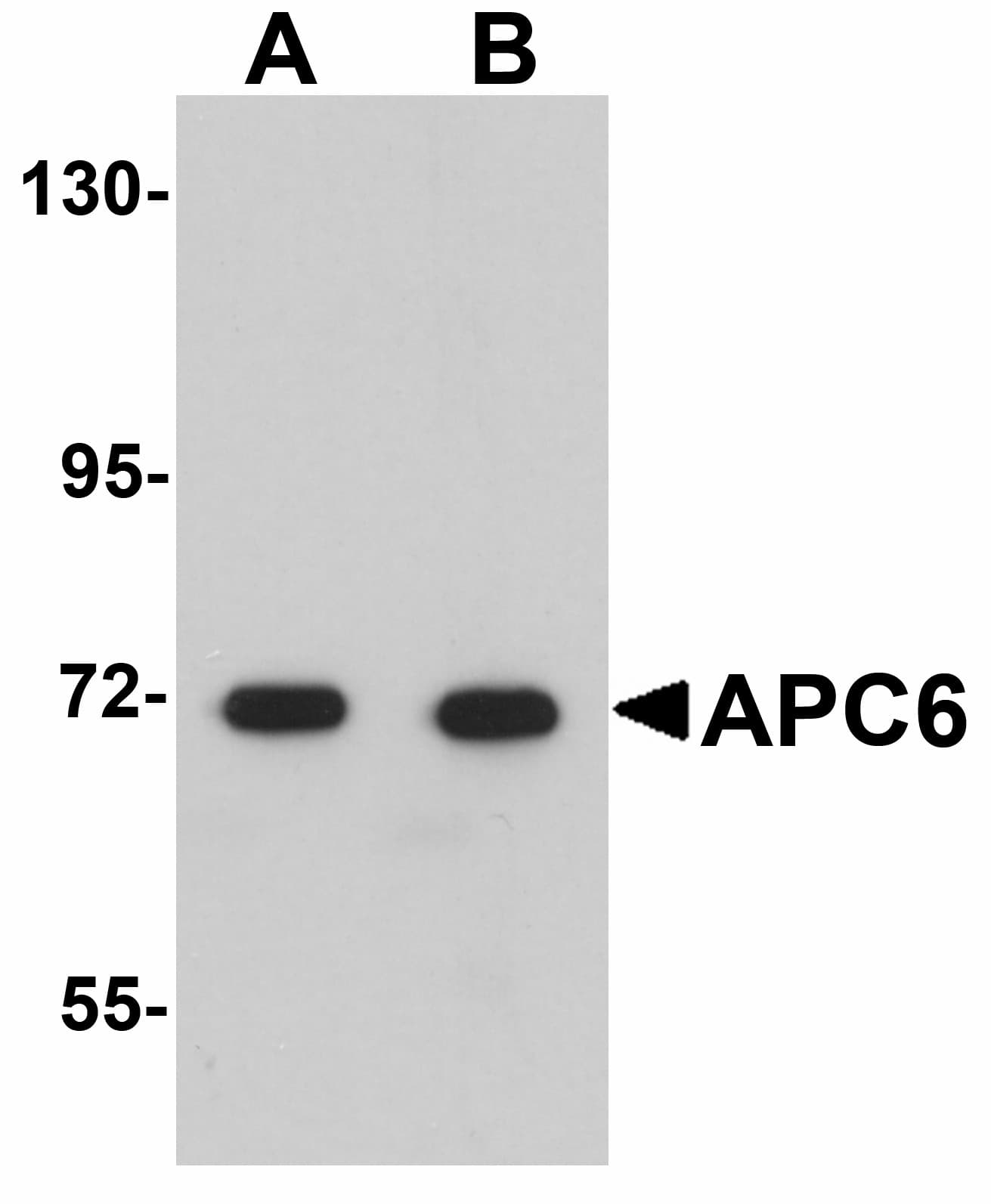 IHC-plus™ Polyclonal Rabbit anti-Human APC6 / CDC16 Antibody (IHC, IF, WB)