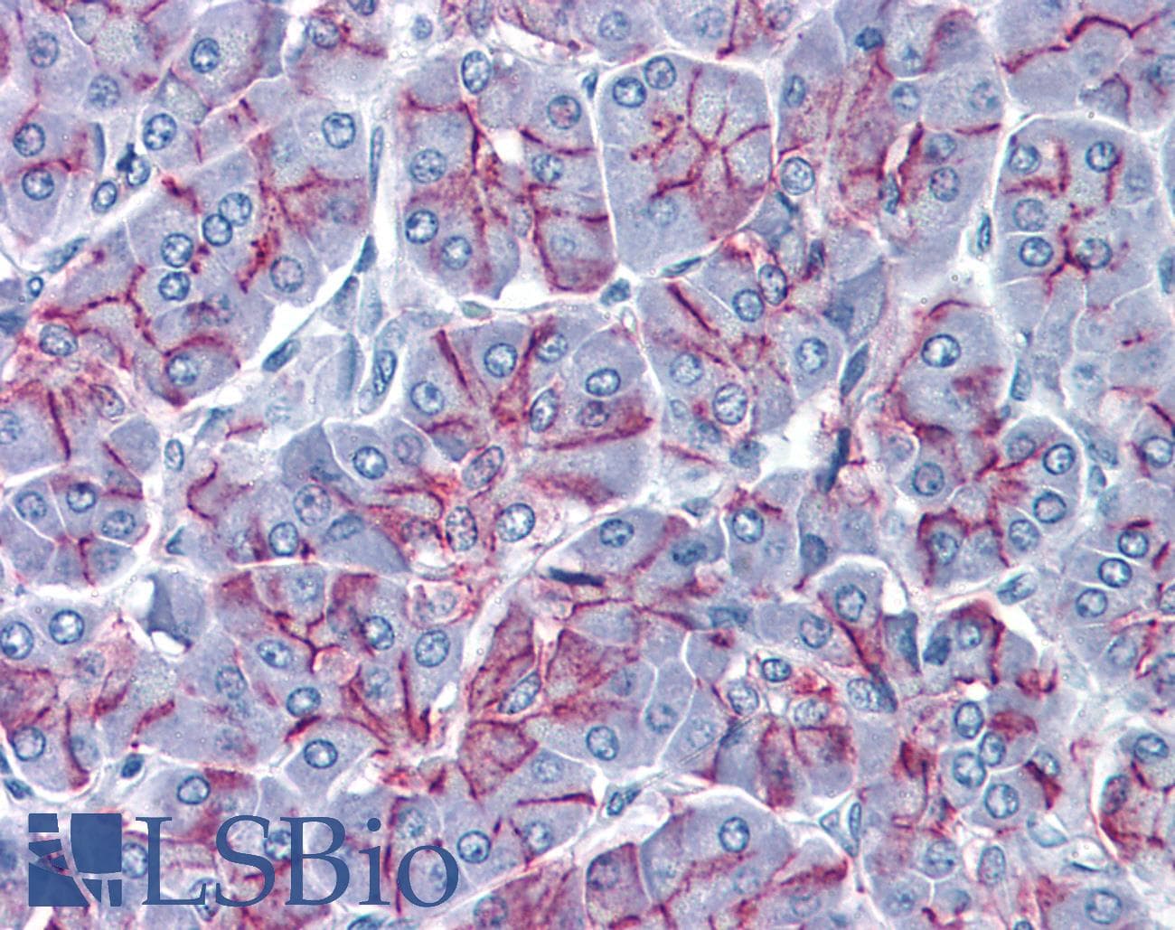 IHC-plus™ CLDN1 / Claudin 1 Antibody (clone 1C5-D9)