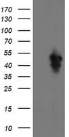 IHC-plus™ SERPINE2 / Nexin Antibody (clone 4E4)