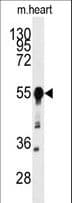 BACE1 / BACE Antibody (aa38-70)