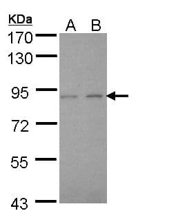 LIMK2 Antibody (aa1-252)