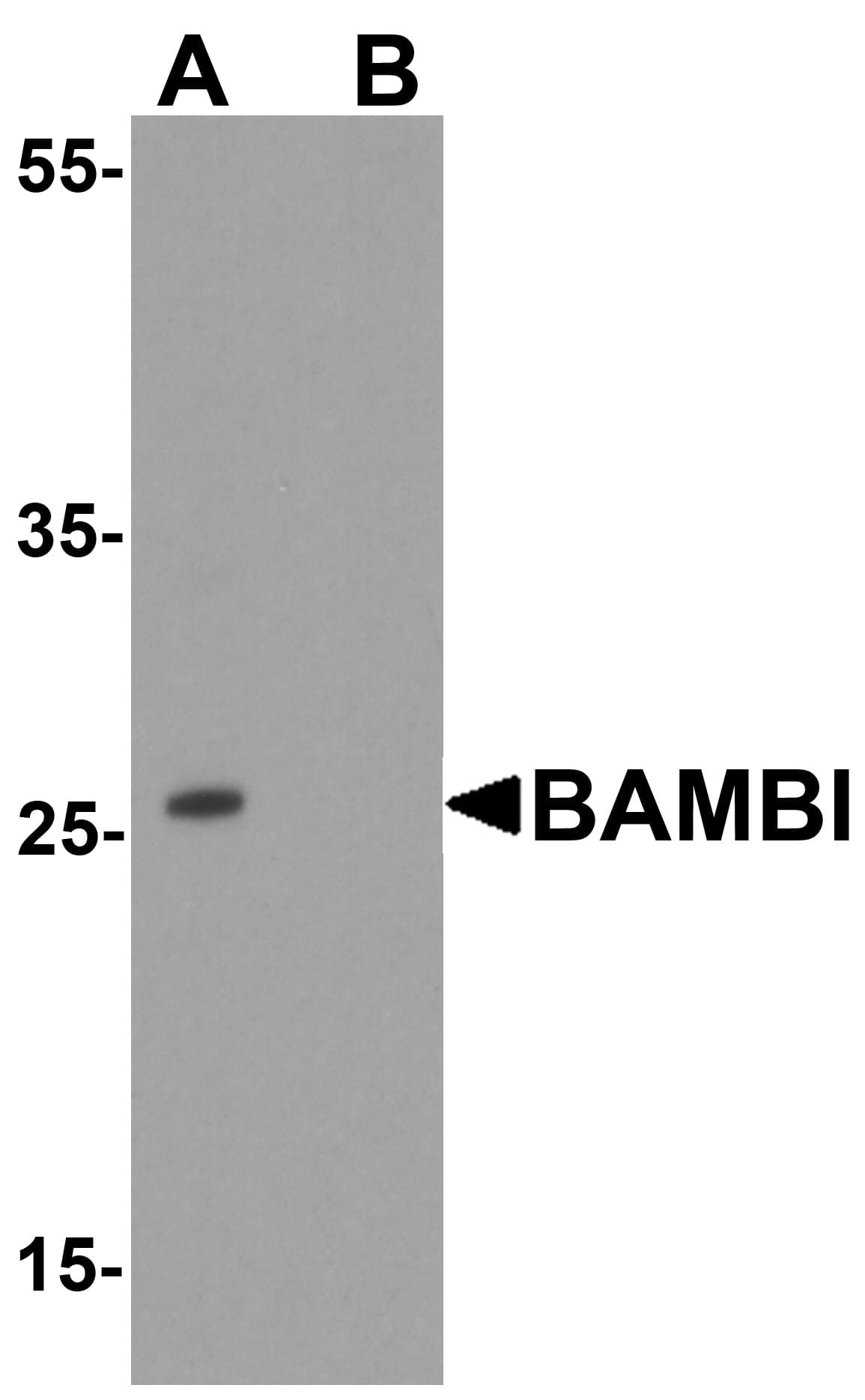 IHC-plus™ Polyclonal Rabbit anti-Human BAMBI Antibody (IHC, IF, WB)