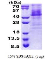 Human HOXC11 Protein (Recombinant His)