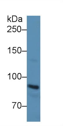 CDH1 / E Cadherin Antibody (aa374-628)
