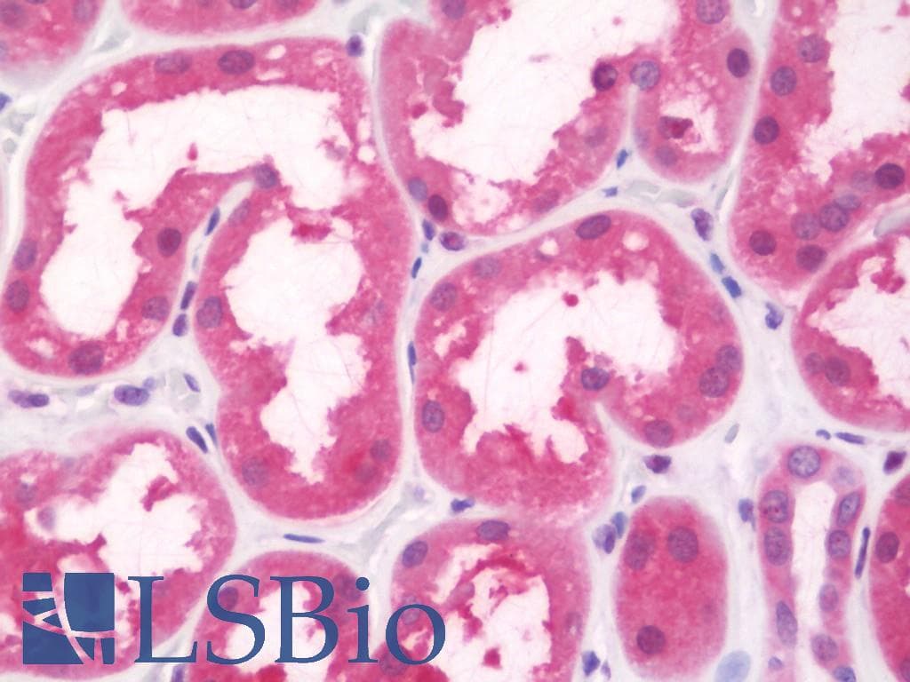IHC-plus™ Polyclonal Rabbit anti-Human FBP1 Antibody (aa1-31, IHC, WB)