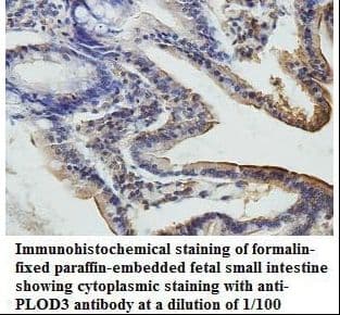 PLOD3 Antibody (aa254-508)