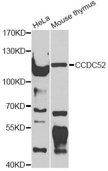 SPICE1 / CCDC52 Antibody