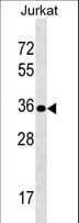 Polyclonal Rabbit anti-Human UPK3B Antibody (aa192-219, WB)