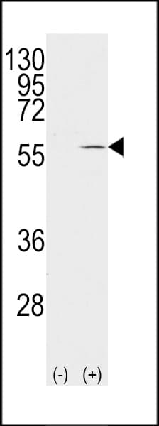 Vimentin Antibody (Ser82)
