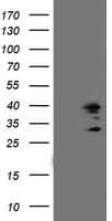 Monoclonal Mouse anti-Human SSR1 Antibody (clone OTI 5D5, WB)