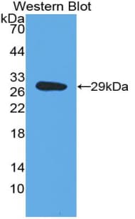 DBH/Dopamine Beta Hydroxylase Antibody (aa335-571)