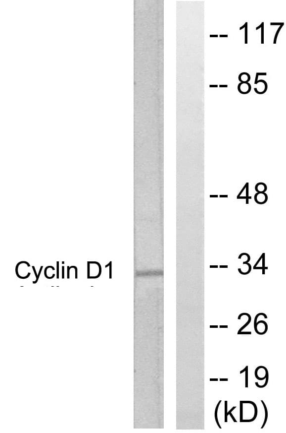 Polyclonal Rabbit anti-Human CCND1 / Cyclin D1 Antibody (aa246-295, IHC, WB)