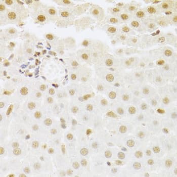 SFN / Stratifin / 14-3-3 Sigma Antibody