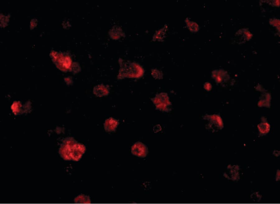 IHC-plus™ JPH3 Antibody
