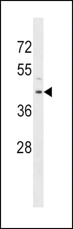 RRM2B / P53R2 Antibody (aa128-157)