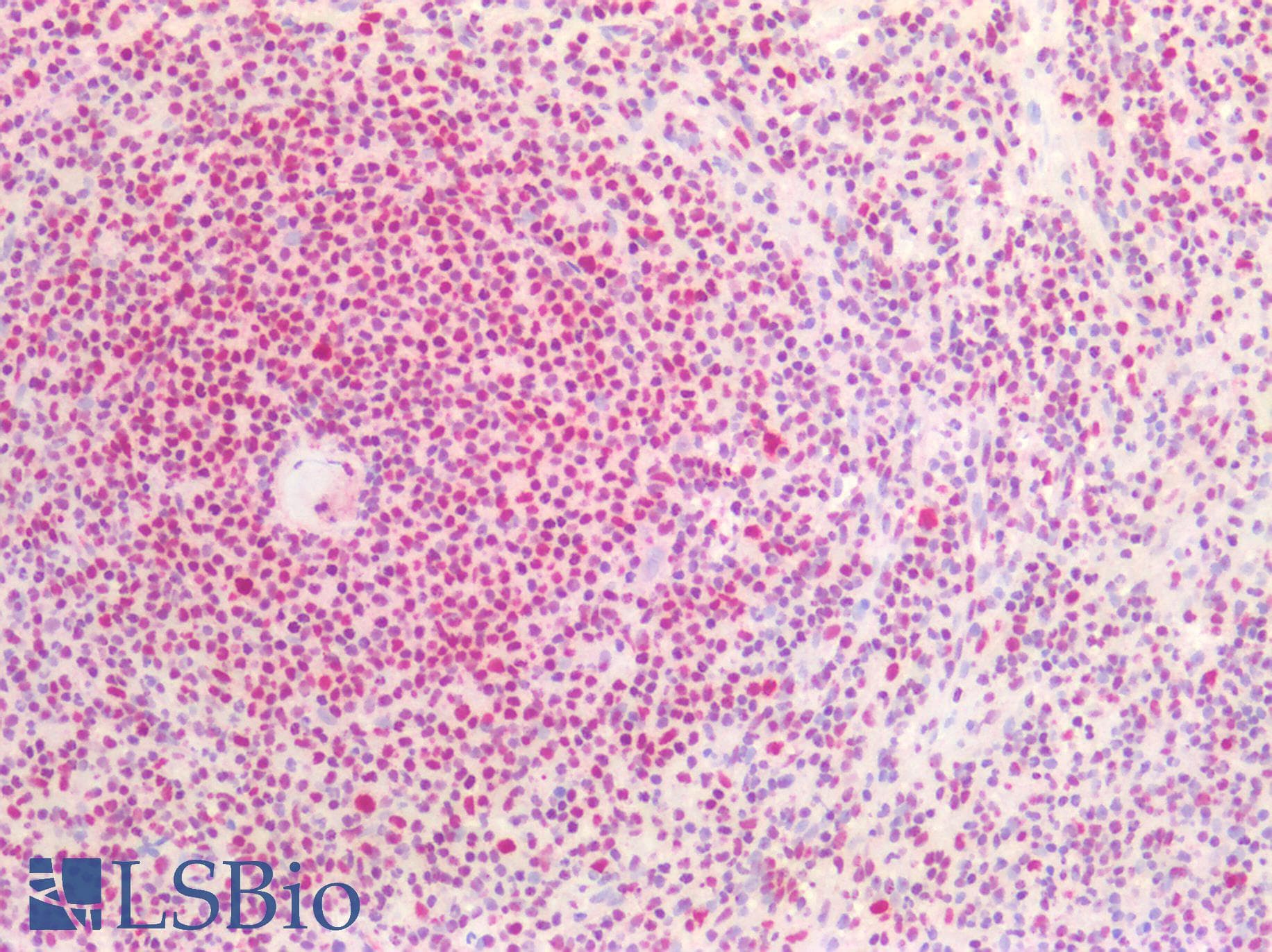PathPlus™ NPM1 / NPM / Nucleophosmin Antibody (clone AT23F1)