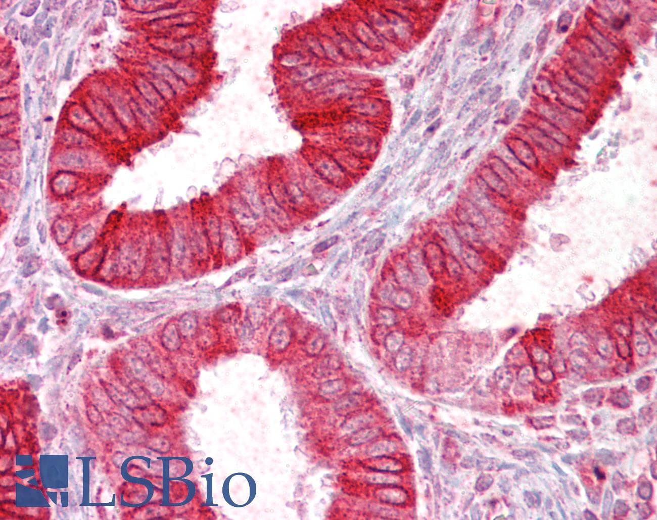 IHC-plus™ SCNN1D Antibody (aa694-704)