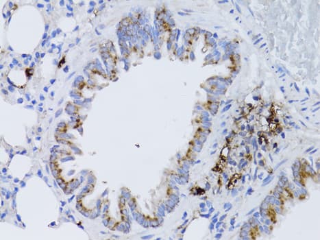 Polyclonal Rabbit anti-Human RARA / RAR Alpha Antibody (IHC, WB)