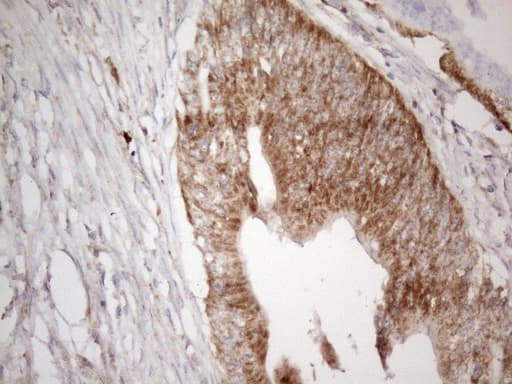 VISA / MAVS Antibody (aa1-247, clone OTI9C4)