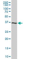 IHC-plus™ CDK6 Antibody (clone 8H4)
