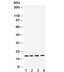 Polyclonal Rabbit anti-Human FGF2 / Basic FGF Antibody (WB)