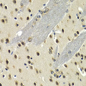 Polyclonal Rabbit anti-Human MAX Antibody (IHC, IF, WB)