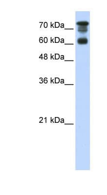 PPP1R13L / iASPP Antibody (aa451-500)
