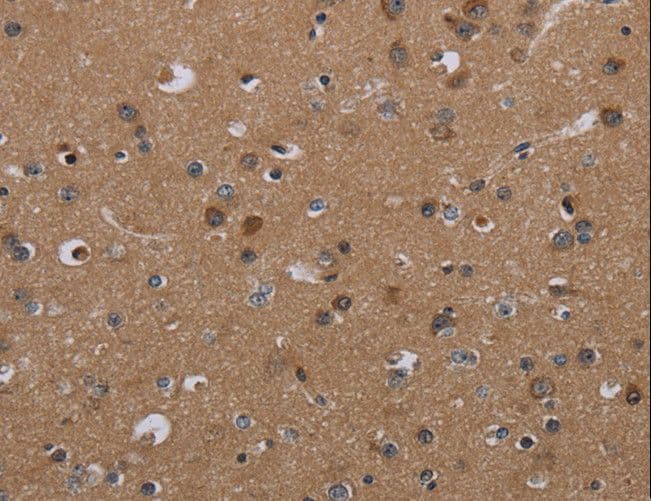 PDGF-CC Antibody