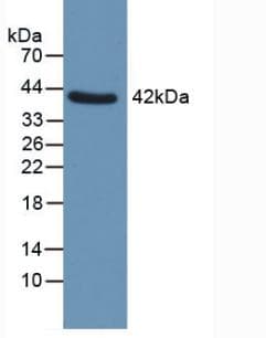 QPCT / QC Antibody (aa29-361, PE)