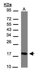 CMTM6 / CKLFSF6 Antibody (aa119-183)