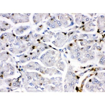 FOSB Antibody (aa264-291)