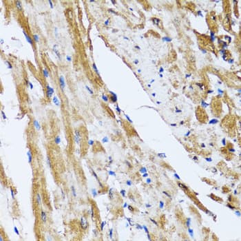 GOLM1 / GP73 / GOLPH2 Antibody