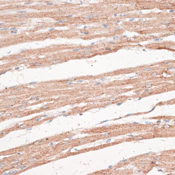 KDM8 / JMJD5 / FLJ13798 Antibody