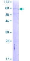Human MYOT / Myotilin Protein (Recombinant GST)