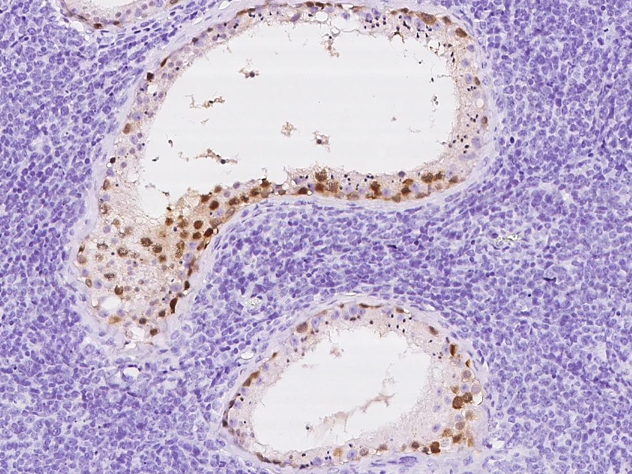PAGE1 Antibody