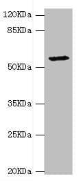 Polyclonal Rabbit anti-Human DPYS / Dihydropyrimidinase Antibody (IHC, WB)