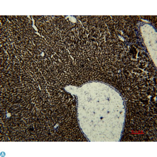 TF / Transferrin Antibody