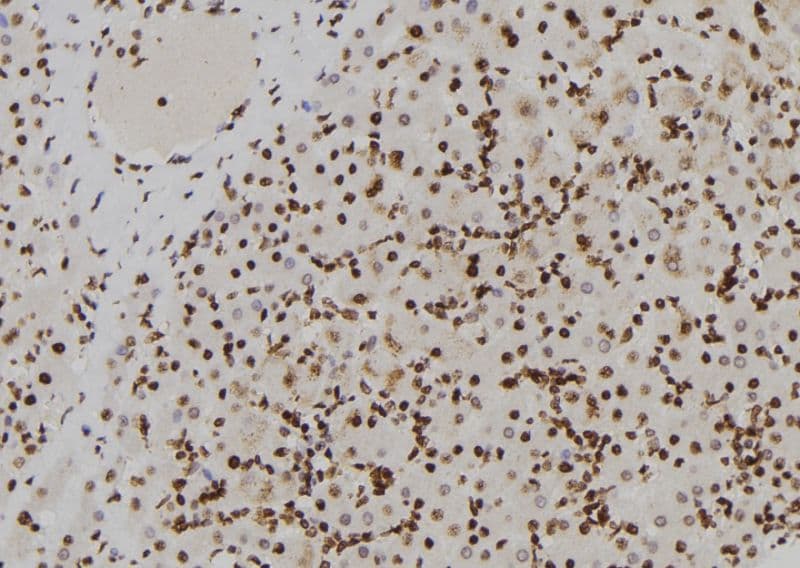 ADGRG7 / GPR128 Antibody