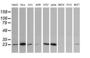 UBE2S / E2 EPF Antibody (clone OTI4H3)
