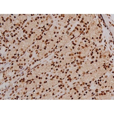 FAK / Focal Adhesion Kinase Antibody (phospho-Tyr397)