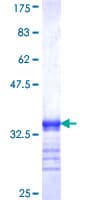 Human TK1 / TK / Thymidine Kinase Protein (Recombinant GST, N-terminus)