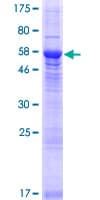 Human CXorf21 Protein (Recombinant GST)