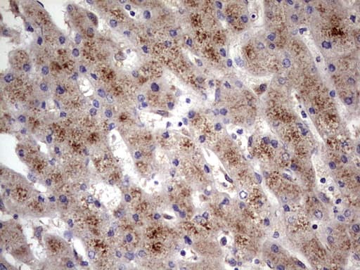 Monoclonal Mouse anti-Human ALDP / ABCD1 Antibody (clone OTI5G6, aa508-745, IHC, WB)